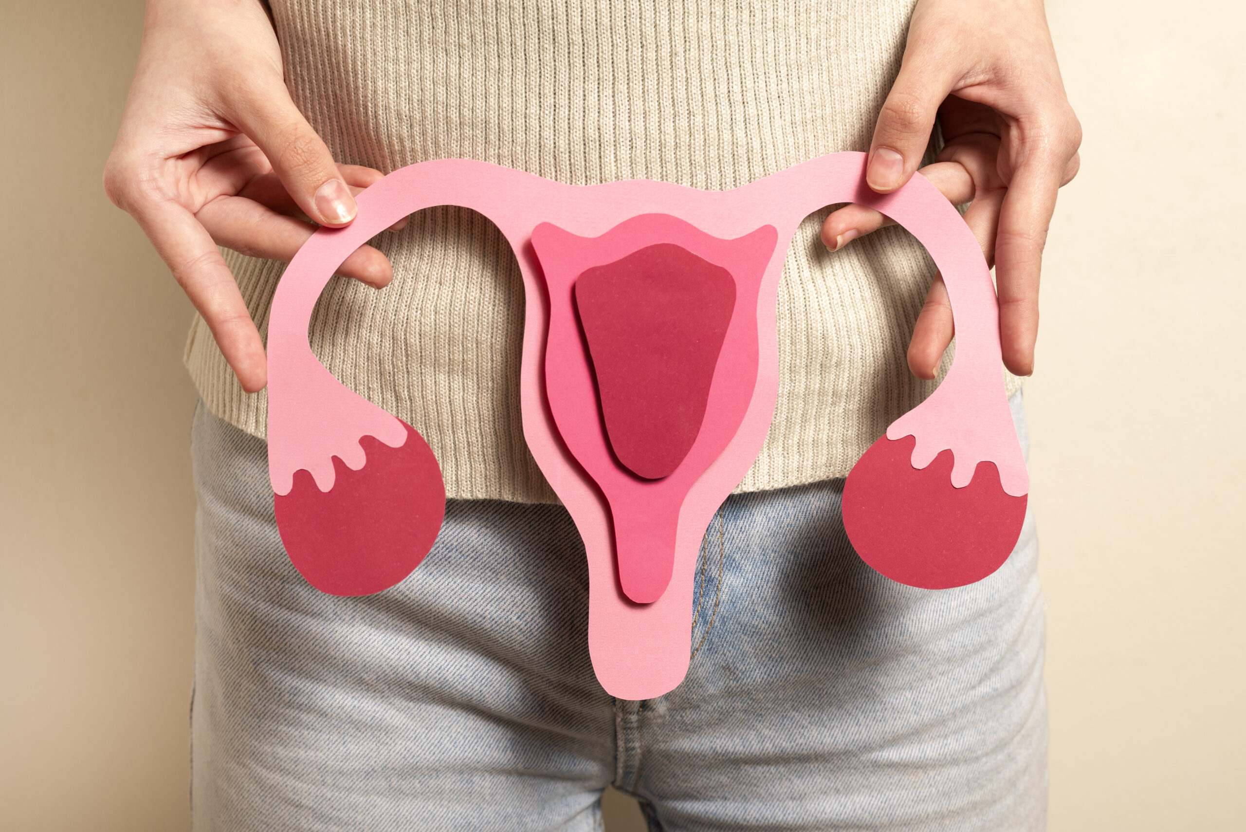 Polycystic Ovary Syndrome(PCOS)