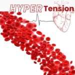 Modification Of HyperTension