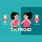 Modification Of Thyroid